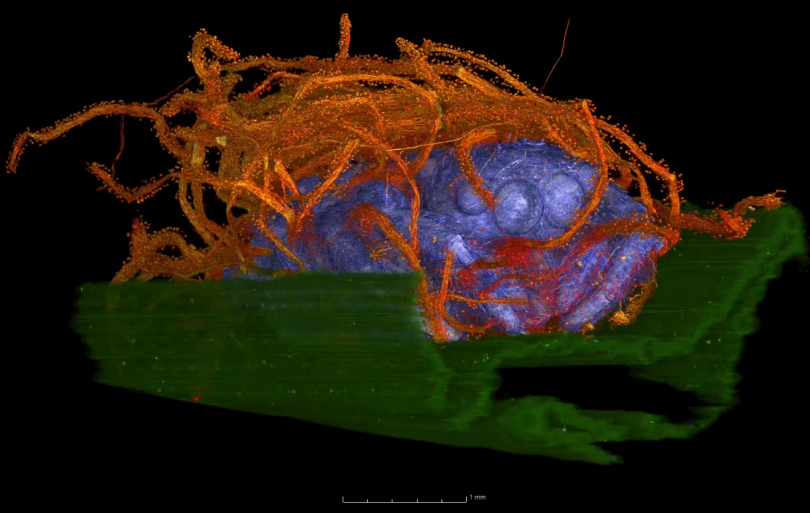 A graphic of a spider CT-scan.